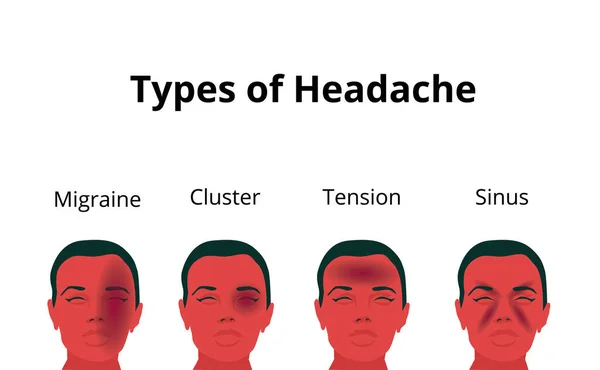 Векторная Иллюстрация Женщины Страдающей Боли Голове Изображаются Четыре Типа Головных — стоковый вектор