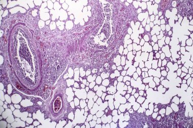 Pnömoni, ışık test