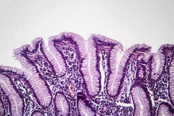 Gastrite superficielle chronique, micrographie photonique — Photo