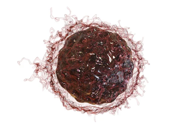 Células cancerosas — Foto de Stock