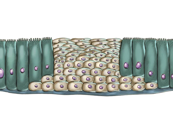 Skivepitelmetaplasi eller respiratoriskt epitel — Stockfoto