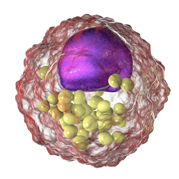 Foam cell, macrophage cells that contain lipid droplets — Stock Photo, Image