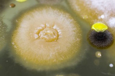 Farklı bakteri ve kalıp kolonileri
