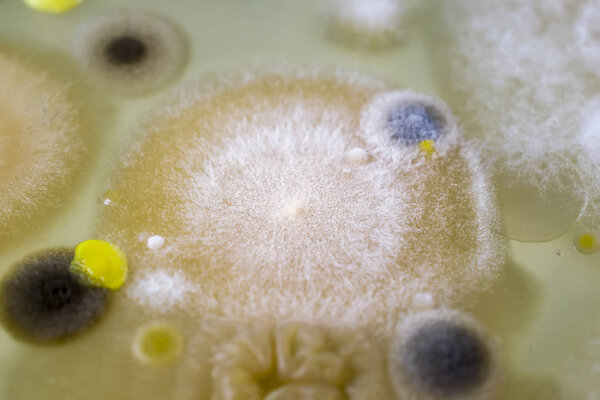 Colonies of different bacteria and molds