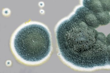 Sabouraud Dekstroz Agar üzerinde Penisillium mantar kolonileri