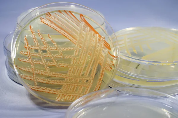 Mixed culture of bacteria grown on Petri dish