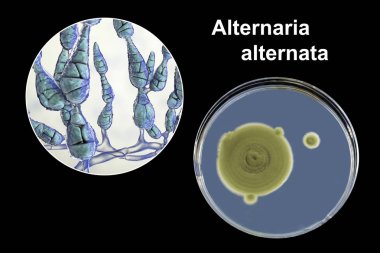 Küf Alternaria alternata, besin ortamında koloninin resmi ve fotoğrafı