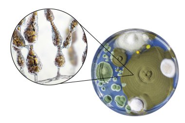 Mold Alternaria alternata, illustration and photo of colony on nutrient medium clipart