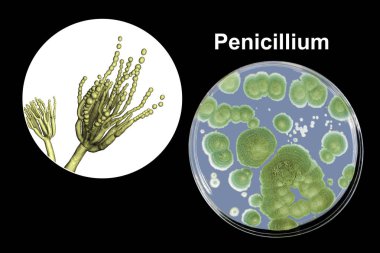 Penisillium küf mantarları, illüstrasyon ve koloni fotoğrafı besin orta yetiştirilen