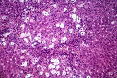 Viral hepatit, ışık mikrografı