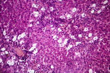 Viral hepatit, ışık mikrografı