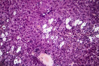 Viral hepatit, ışık mikrografı