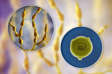 Küf Alternaria alternata, besin ortamında koloninin resmi ve fotoğrafı
