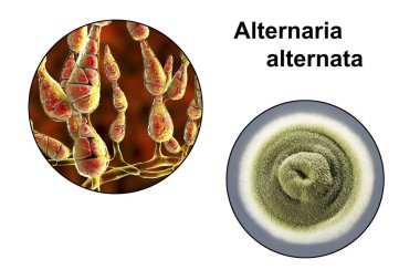 Küf Alternaria alternata, besin ortamında koloninin resmi ve fotoğrafı