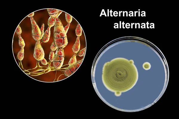 Mold Alternaria alterata, απεικόνιση και φωτογραφία αποικίας σε θρεπτικό μέσο — Φωτογραφία Αρχείου