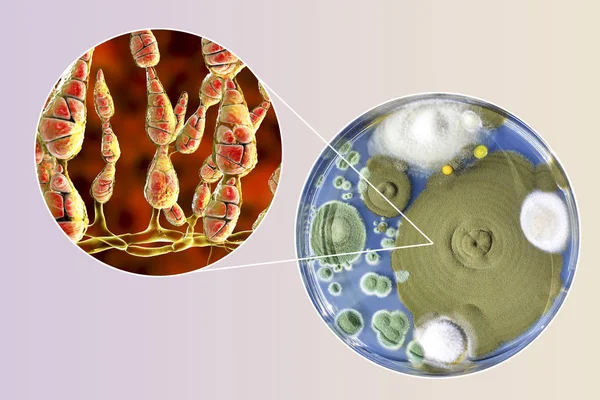 Mold Alternaria alternata, illustration and photo of colony on nutrient medium — Stock Photo, Image