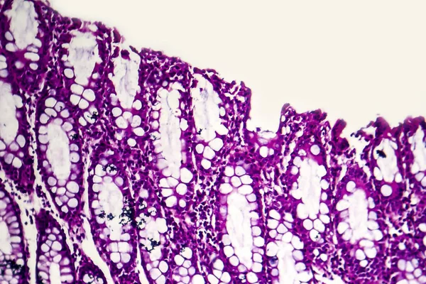 Disentería binaria y micrografía ligera — Foto de Stock