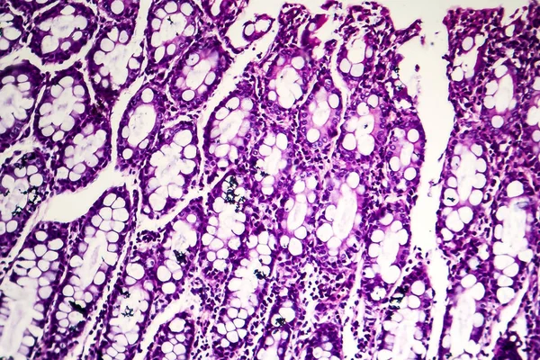 Disentería binaria y micrografía ligera — Foto de Stock