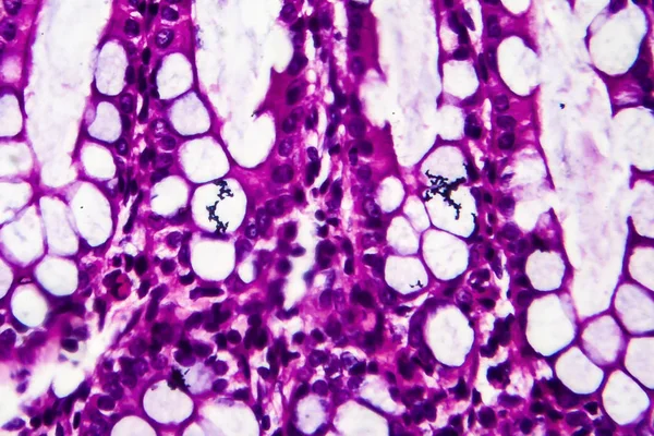 Disenteria Bacillar, microscópio de luz — Fotografia de Stock