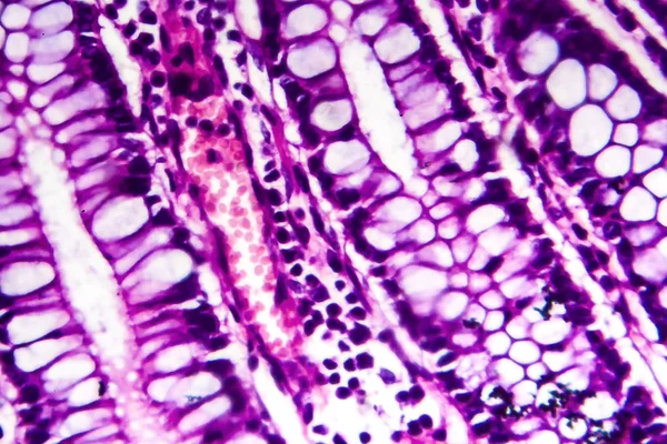 Dissenteria batterica, micrografia leggera — Foto Stock