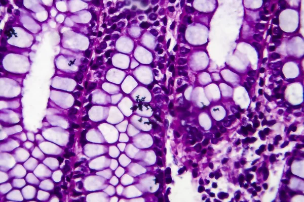 Disenteria Bacillar, microscópio de luz — Fotografia de Stock