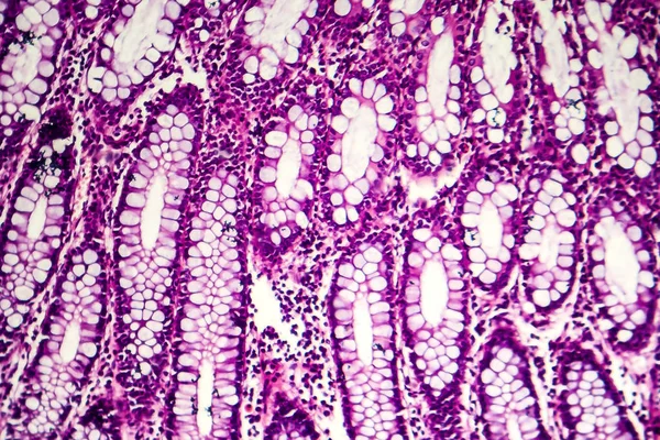 Disenteria Bacillar, microscópio de luz — Fotografia de Stock