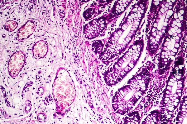 Disenteria Bacillar, microscópio de luz — Fotografia de Stock