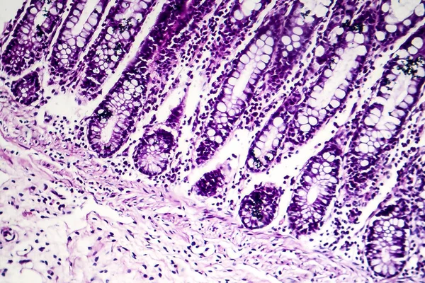 Bacillär dysenteri, ljusmikrograf — Stockfoto