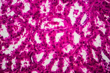 Tüplü atrofi, hafif mikrograf, mikroskop altında fotoğraf. Yüksek büyütme