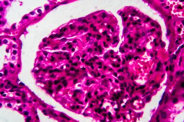 Tüplü atrofi, hafif mikrograf, mikroskop altında fotoğraf. Yüksek büyütme