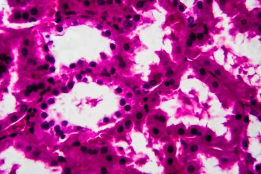 Tüplü atrofi, hafif mikrograf, mikroskop altında fotoğraf. Yüksek büyütme