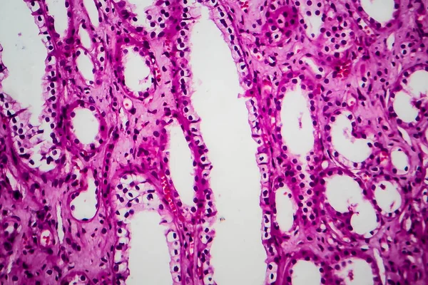 Buisatrofie Lichtmicrograaf Foto Onder Microscoop — Stockfoto