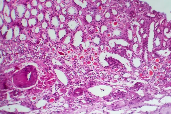 管状萎缩 光镜下摄影 — 图库照片