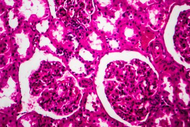 Tüplü atrofi, hafif mikrograf, mikroskop altında fotoğraf. Yüksek büyütme