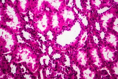 Tüplü atrofi, hafif mikrograf, mikroskop altında fotoğraf. Yüksek büyütme