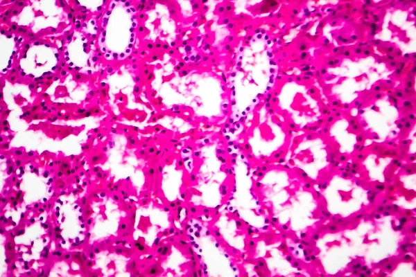Tubular Atrophy Light Micrograph Photo Microscope — Stock Photo, Image