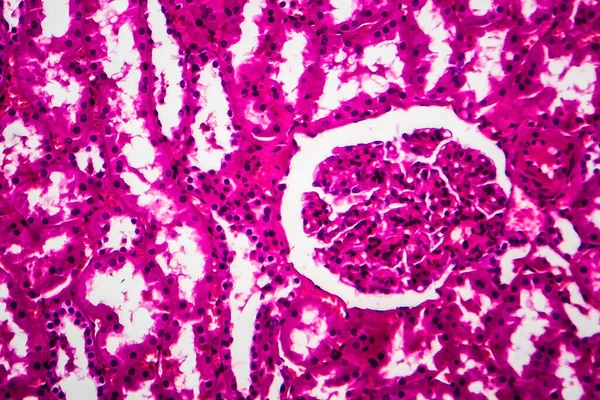 Atrofie Tubulară Micrografie Ușoară Fotografie Sub Microscop Mărire Mare — Fotografie, imagine de stoc