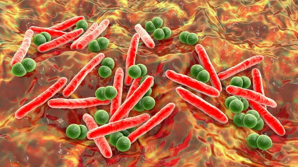 Respiratory pathogens, bacteria Mycobacterium tuberculosis and Streptococcus pneumoniae, 3D illustration. The causative agents of tuberculosis and pneumonia