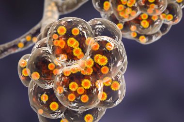 Coronavirus zatürree, Covid-19 Roman ile dolu alveoller Çin Wuhan coronavirüsü, 2019-nCoV, 3D illüstrasyon