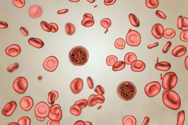 Parásitos Babesia Dentro Los Glóbulos Rojos Agente Causal Babesiosis Ilustración —  Fotos de Stock