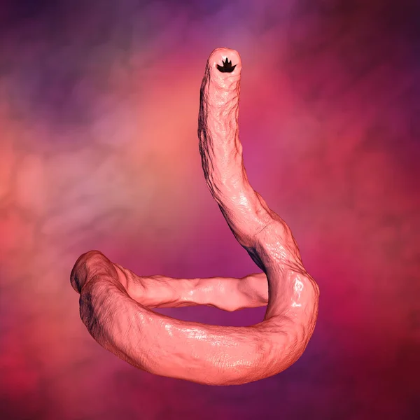 Ancylosoma Parásito Anquilostoma Ilustración Ancylostoma Duodenale Puede Infectar Seres Humanos —  Fotos de Stock