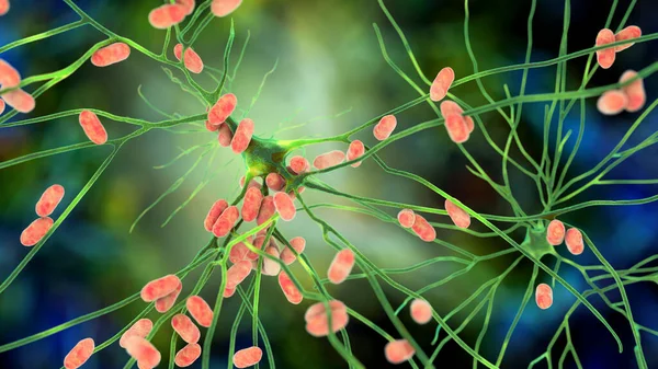 Bacteriën Infecteren Neuron Hersencel Illustratie Conceptuele Illustratie Van Bacteriële Encefalitis — Stockfoto