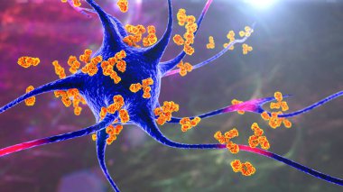 Antikorlar nörona saldırıyor, 3 boyutlu illüstrasyon. Otoimmün nörolojik hastalıklar kavramı