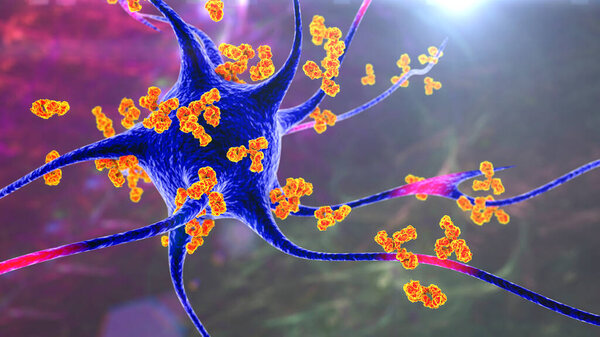 Antibodies attacking neuron, 3D illustration. Concept of autoimmune neurologic diseases
