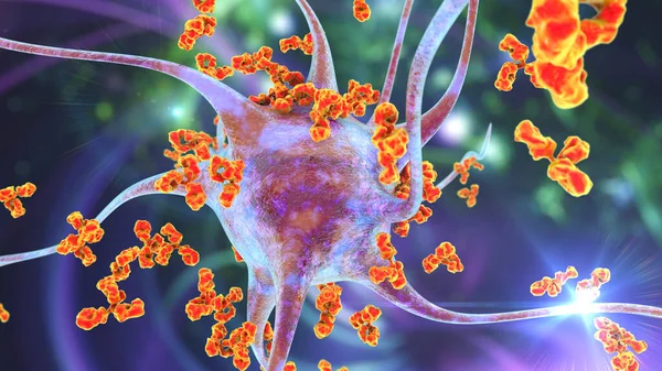 Antibodies Attacking Neuron Illustration Concept Autoimmune Neurologic Diseases — Stock Photo, Image