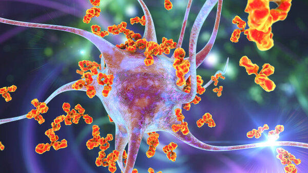Antibodies attacking neuron, 3D illustration. Concept of autoimmune neurologic diseases