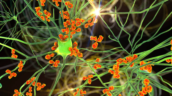 Antibodies attacking neuron, 3D illustration. Concept of autoimmune neurologic diseases