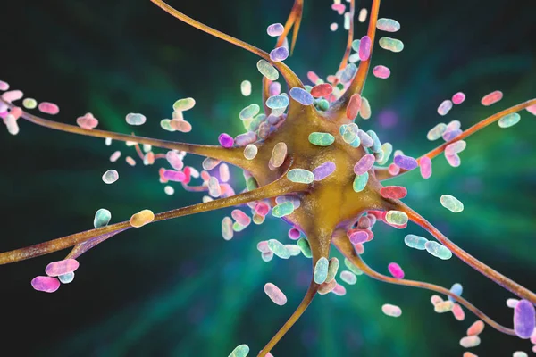 Bakterien Infizieren Neuronen Gehirnzellen Illustration Konzeptionelle Darstellung Bakterieller Enzephalitis Meningitis — Stockfoto