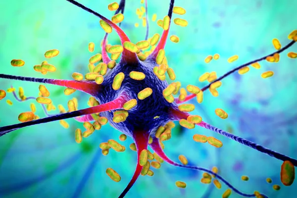 Bacteria infecting neuron, brain cell, 3D illustration. Conceptual illustration of bacterial encephalitis, meningitis, bacterial infection of brain tissue
