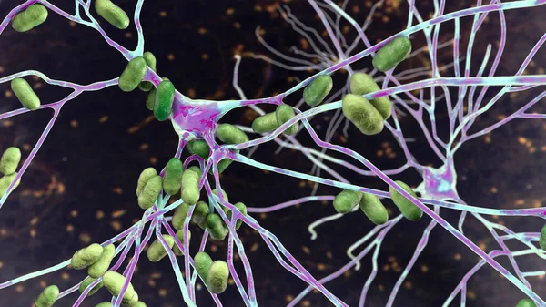 Bacteria infecting neurons, brain cells, 3D illustration. Conceptual illustration of bacterial encephalitis, meningitis, bacterial infection of brain tissue